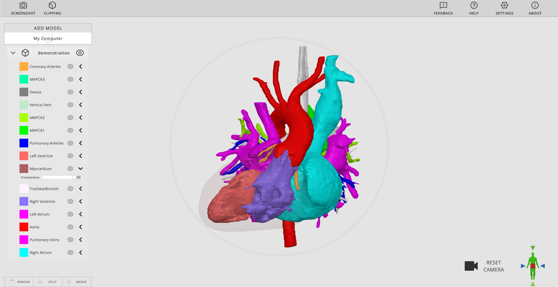 Captura de pantalla del corazón del Hospital Infantil Rady